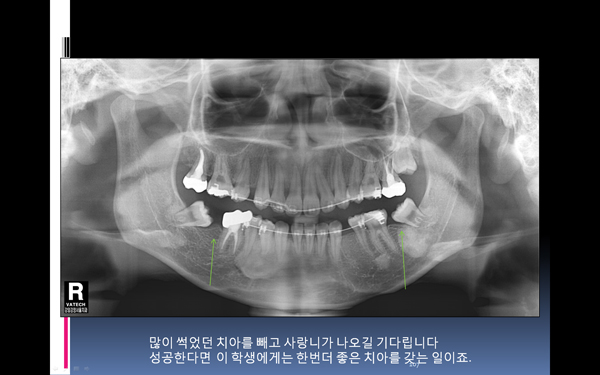 114.jpg